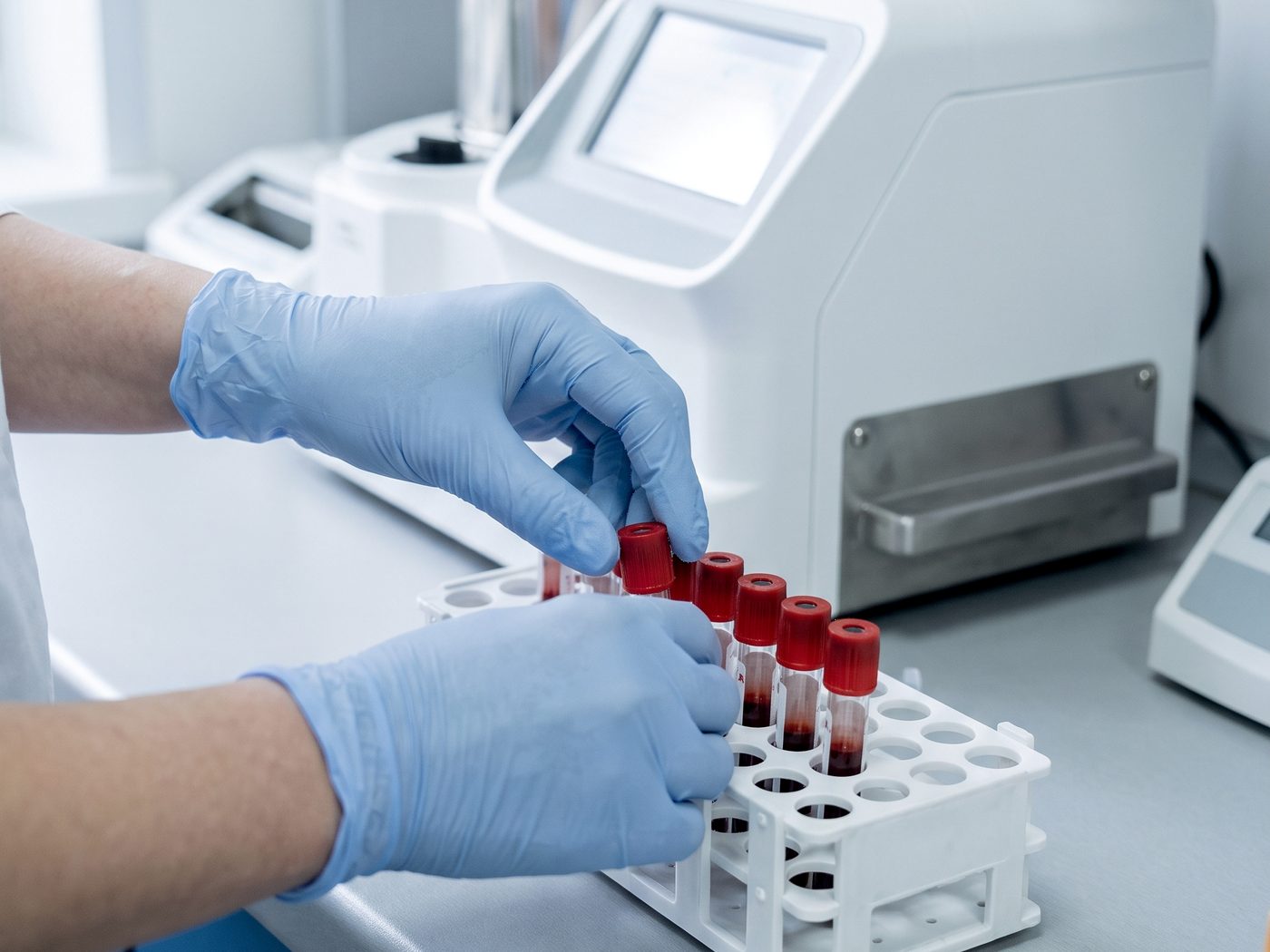 Gloved hands loading sample tubes into a laboratory analyser